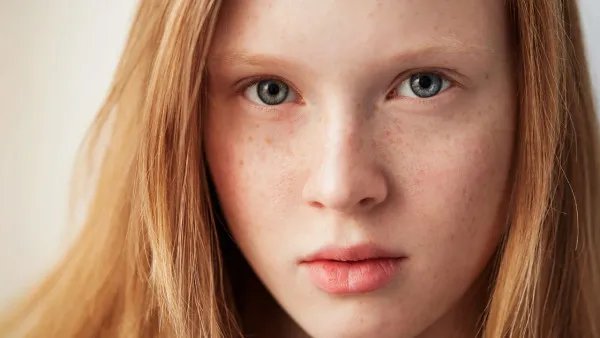 脸上长斑怎么调理