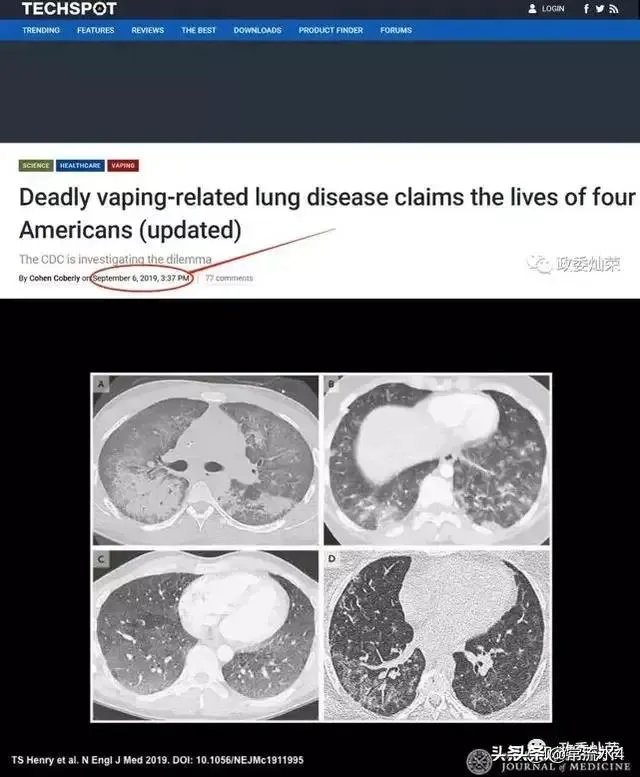 美国新冠肺炎病毒已突破十万，会比意大利更糟糕吗？