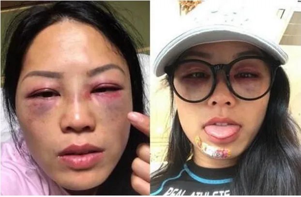 女星录节目为什么会被暴打？