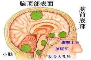 脑膜解剖层次结构图