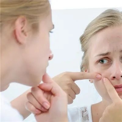 左脸颊长痘的调理方法