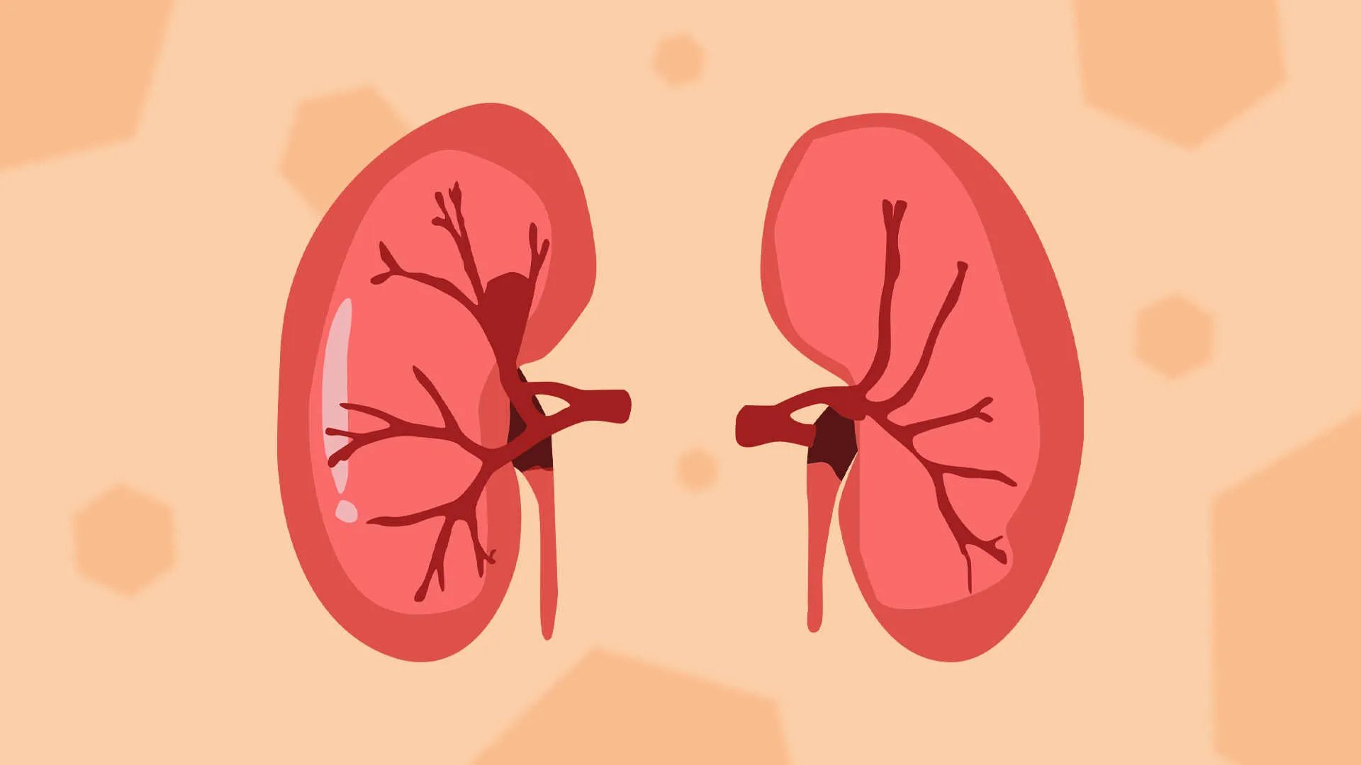 结石病人不能吃哪些