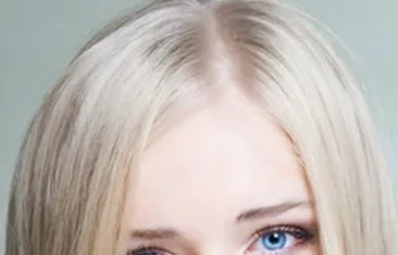 抬头纹能去掉吗