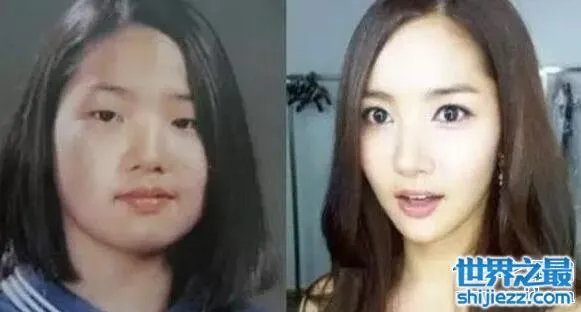 朴敏英整容前后照片对比，简直丑女大翻身 