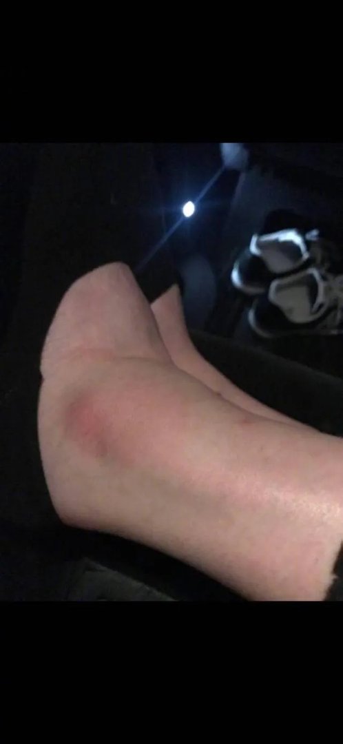 2017年维密秀，对待奚梦瑶摔跤事件，来尬聊会儿你第一时间关注到的是什么？