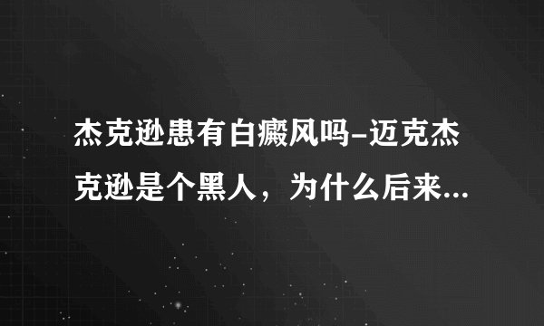 杰克逊患有白癜风吗-迈克杰克逊是个黑人，为什么后来他居然那么白？