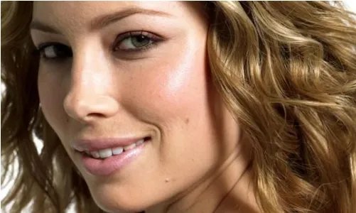 激光去斑有用吗