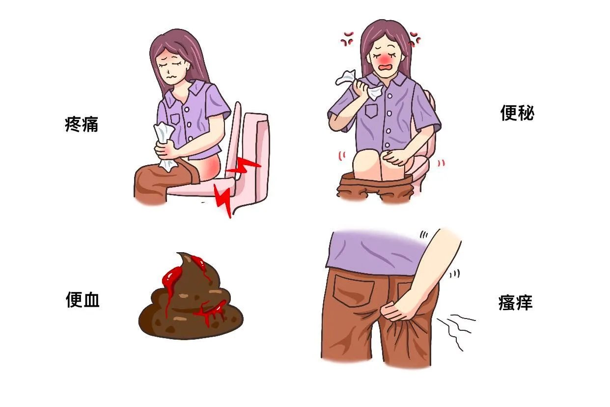 女性长痔疮的症状有哪些图片
