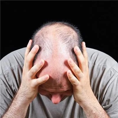 霸王洗发水防脱发 好不好