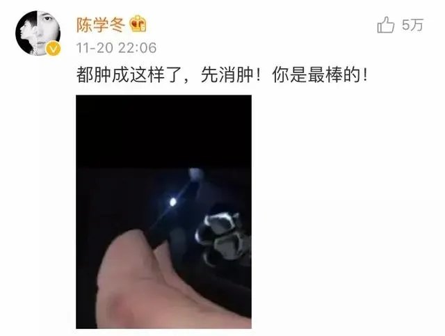 2017年维密秀，对待奚梦瑶摔跤事件，来尬聊会儿你第一时间关注到的是什么？