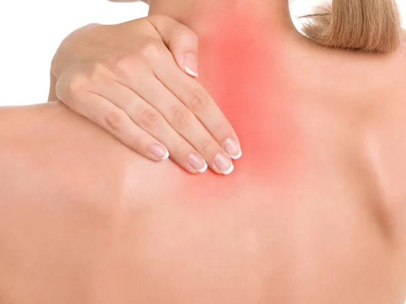 去痘的简单方法