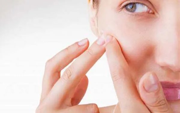 激光祛斑大概多少钱