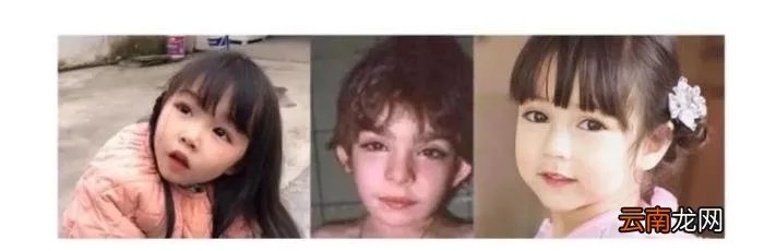 歌舞伎综合征 歌舞伎综合征能活多久