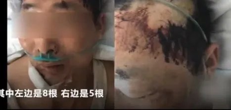 制止小孩乱跑遭打是怎么回事？