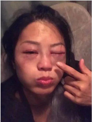 女星录节目为什么会被暴打？