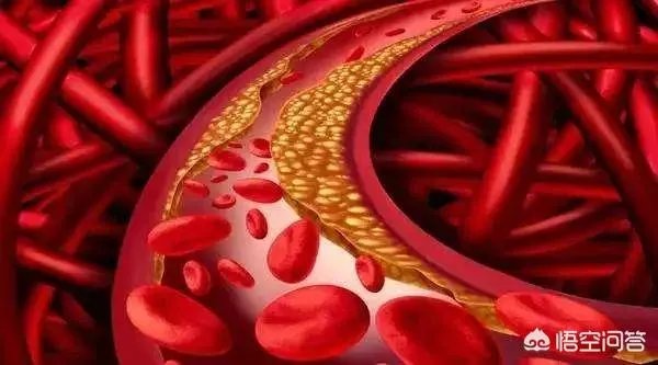 演员程思寒，因心梗去世，享年58岁，心梗喜欢找上哪几类人？又该如何预防？