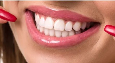四环素牙齿美白有哪些方法