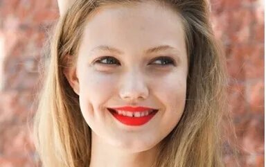 乌鲁木齐哪家医院做去法令纹整形好?一次需要多少钱