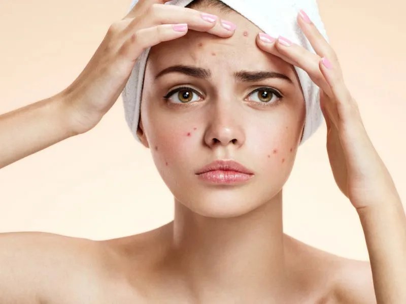 额头上长疙瘩的原因