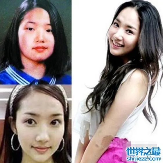 朴敏英整容前后照片对比，简直丑女大翻身 