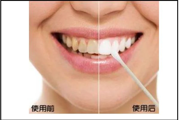 使用白牙素的注意事项