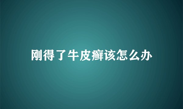 刚得了牛皮癣该怎么办