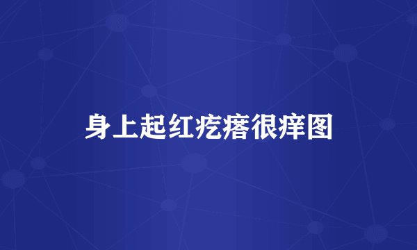 身上起红疙瘩很痒图