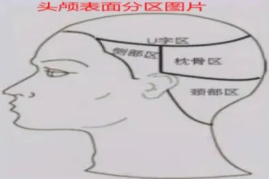 头颅表面分区图片