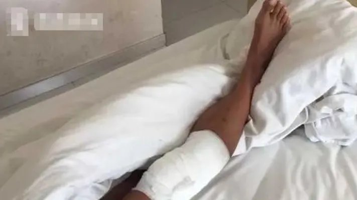 对于大爷烧伤后先抹盐水后抹大酱网友是如何评价的？