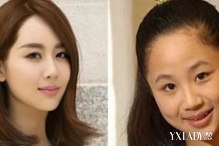 杨紫整容前后照片对比网友都惊呼其似菲儿