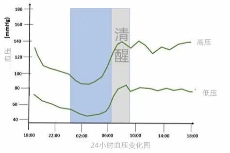 血压波动曲线图
