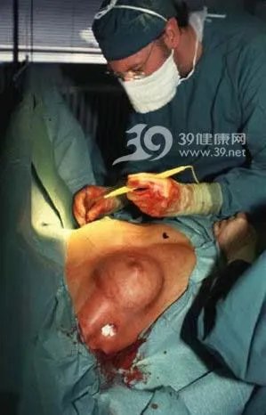 美女“隆胸手术”全程实录（组图）