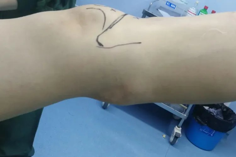 膝盖各个部位疼痛图解