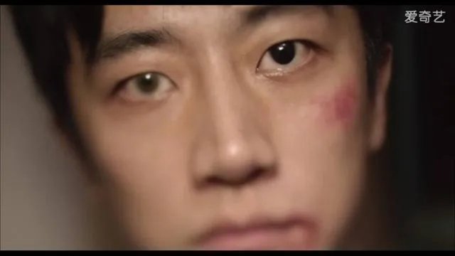 大家对男明星整容有什么看法?