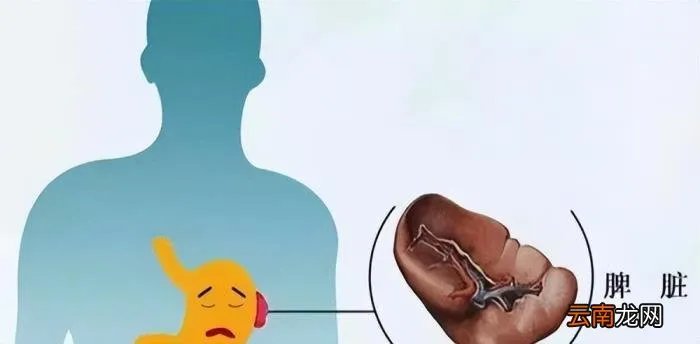 干咳无痰吃什么药 干咳无痰吃什么药效果最好