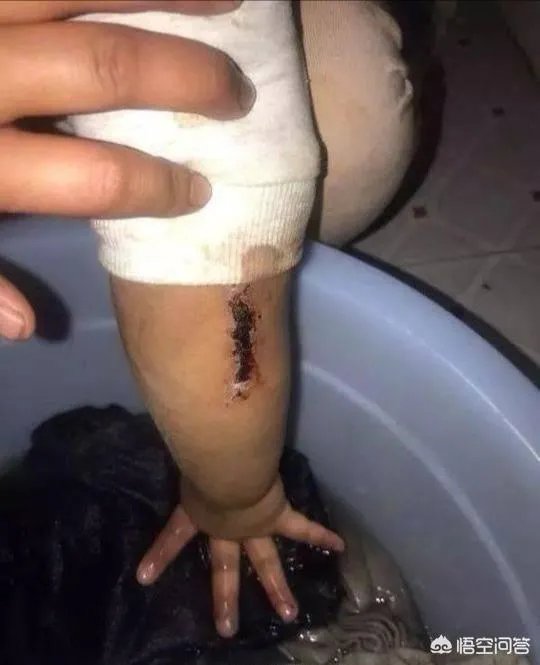 泉州11岁女孩疑似遭后妈毒打，伤痕累累, 你怎么看？