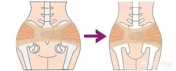 有的孕产宝妈课堂讲到“身材好不好就得先看腰”，那么产后水桶腰，怎么恢复呢？