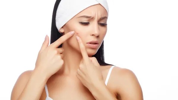 如何治疗青春痘痤疮