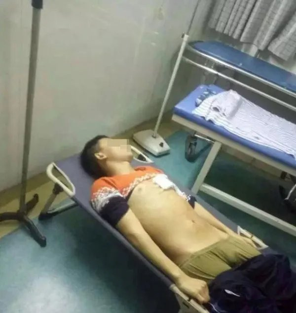 湖北17岁高中生刀砍老师后被老师群殴抢救无效死亡是怎么回事？