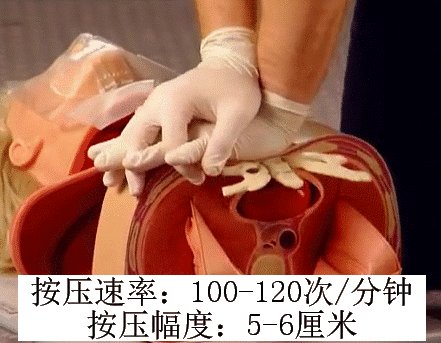 如果心肺复苏时医生将患者肋骨按断，到底需不需要承担责任？为什么？