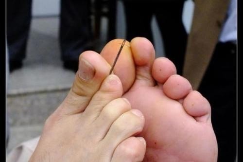 为什么努西达的身体会不断的长出铁丝,甚至有的铁丝一夜之间还会长到10公分?