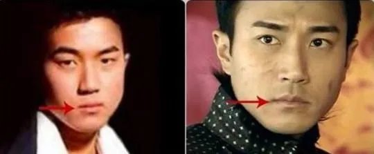 大家对男明星整容有什么看法?