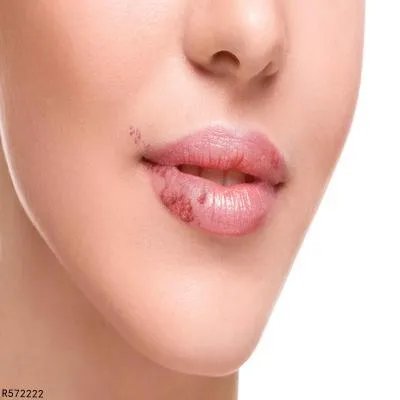 舌头上起泡是什么原因导致的 了解舌头上起泡的主因