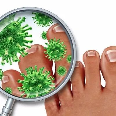 脚指甲有横纹是怎么回事