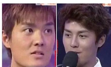 大家对男明星整容有什么看法?