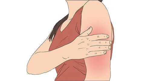 新冠疫苗接种常见不良反应