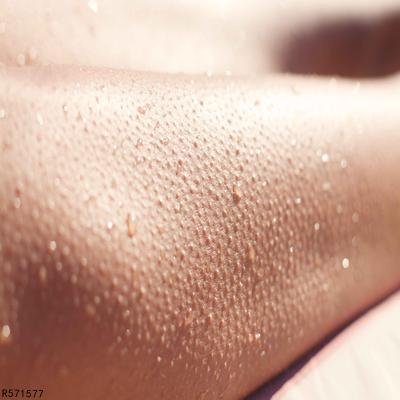 腿上有鸡皮疙瘩怎么去除