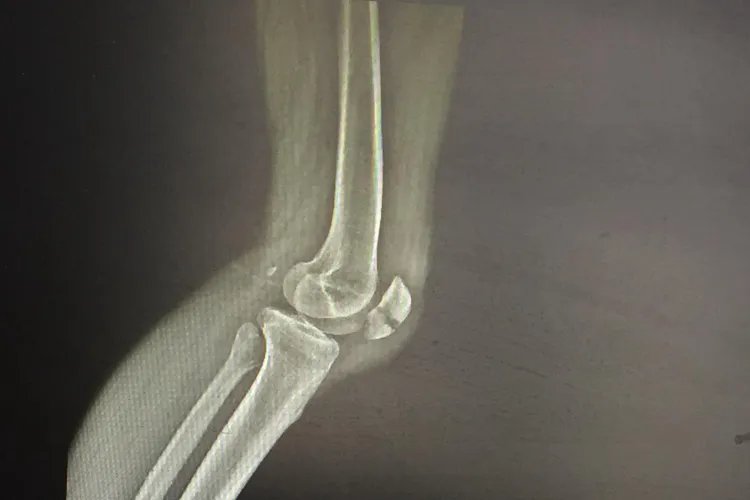 膝盖各个部位疼痛图解