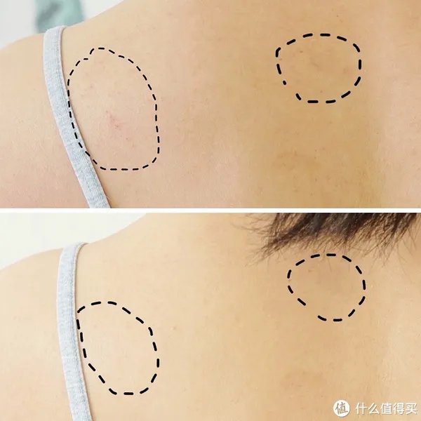 皮肤长期拔干，可能是自来水出了问题——A.O.史密斯美容软水机