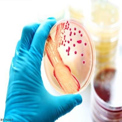 血常规能检查出什么病 血常规可以发现这三种疾病